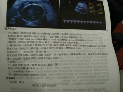 怀孕一个月胎儿有多大