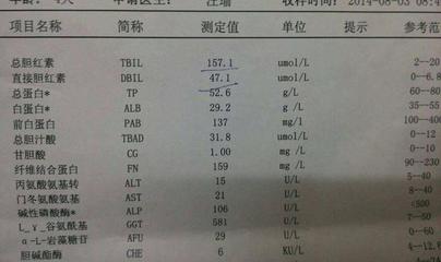 黄疸值在多少属于严重