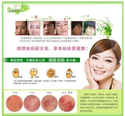 预防痘痘的化妆品