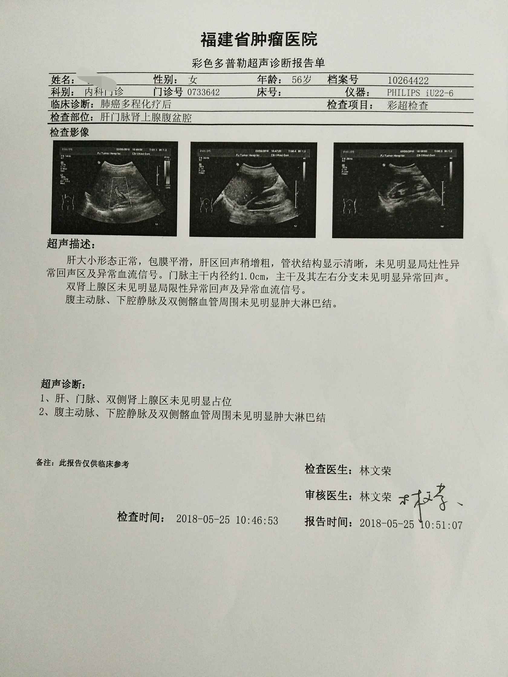 新生儿血小板偏低