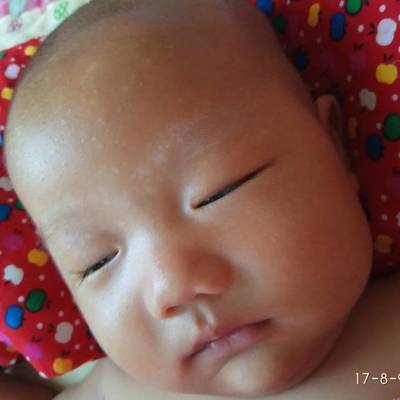 新生儿白点点是什么