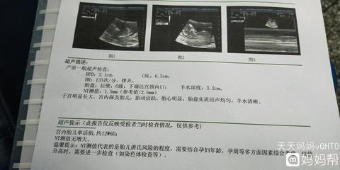 胎盘后壁几个月显怀