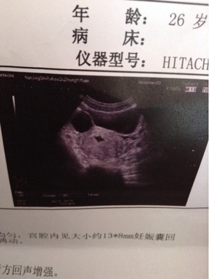 怀孕40天能看出男女吗