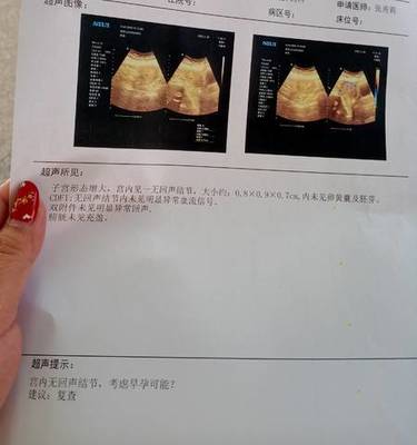 怀孕五周肚子疼是怎么回事