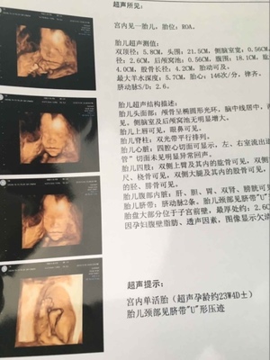 四个月胎动