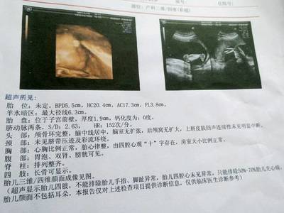 怀孕五个月的胎儿有多大