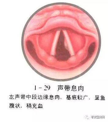 喉咙充血是怎么回事