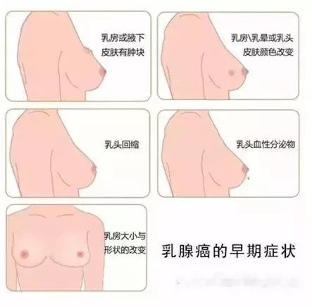 腋下淋巴肿大是怎么回事