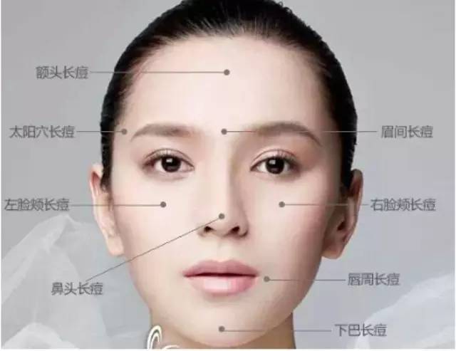 眉间粉刺是什么原因