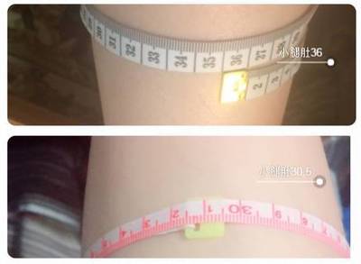 大腿根肉多怎么减肥