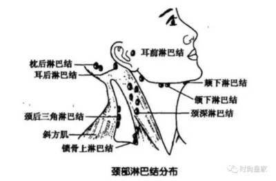淋巴发炎是怎么回事