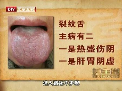舌尖裂纹是怎么回事