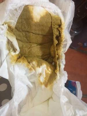 宝宝拉的粑粑黏糊糊的