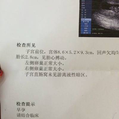 宝宝几周有胎心