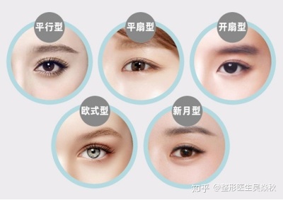 双眼皮哪种类型好看