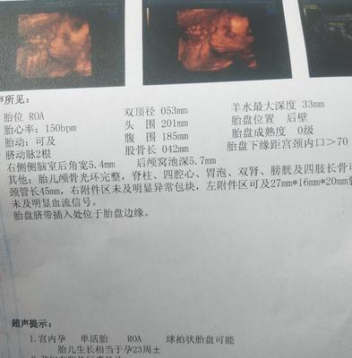 六个月球拍状胎盘可以改善吗
