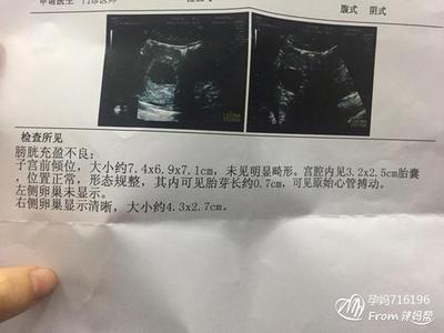 怀孕初期少量出血正常吗