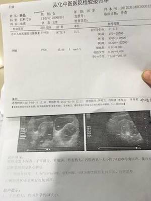 怎么才能确定是否怀孕