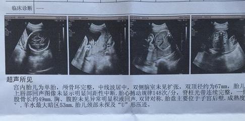 怀孕6个月胎儿图片