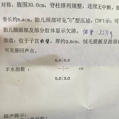 33周宝宝4斤正常吗
