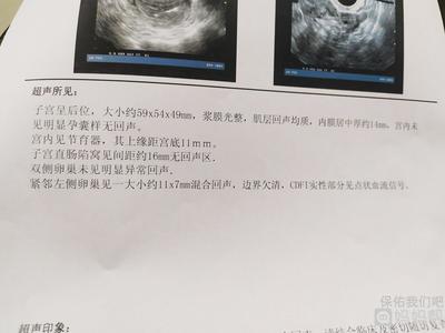 带环怀孕了怎么做流产