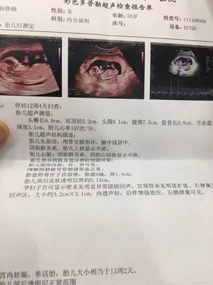 怎么测试男女宝宝最准