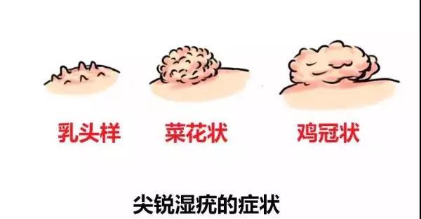 疣体一个月能长大多少