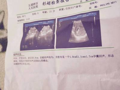 怀孕多少天小孩出生