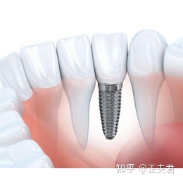 牙齿松动疼怎么治疗