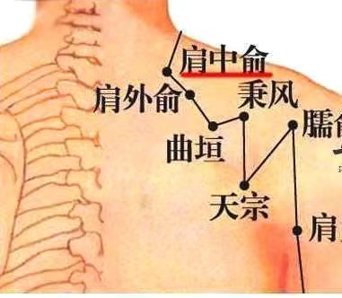 曲池疼是怎么回事
