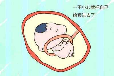 为什么胎儿会缺氧