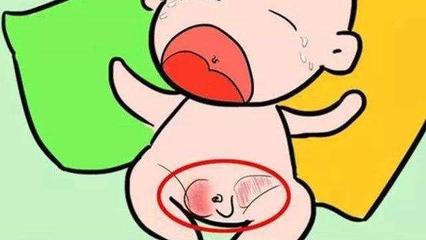 男宝宝蛋蛋疝气症状