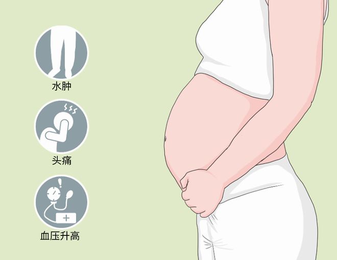 怀孕一个月啥症状