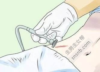 疤痕修复最佳时间