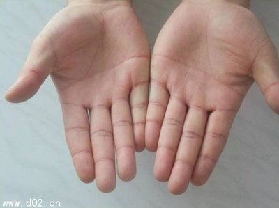 男人双手断掌命运详解