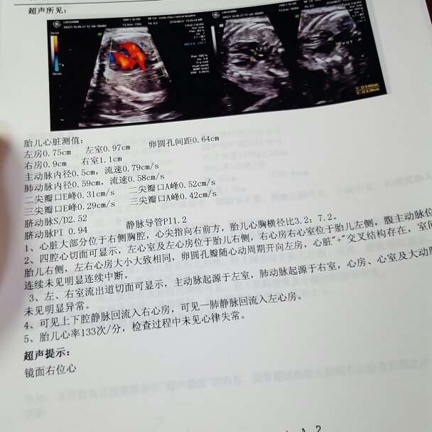 胎儿心脏检查