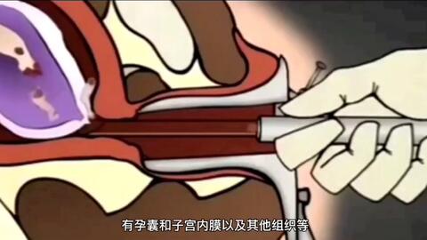 小月子禁忌及注意事项