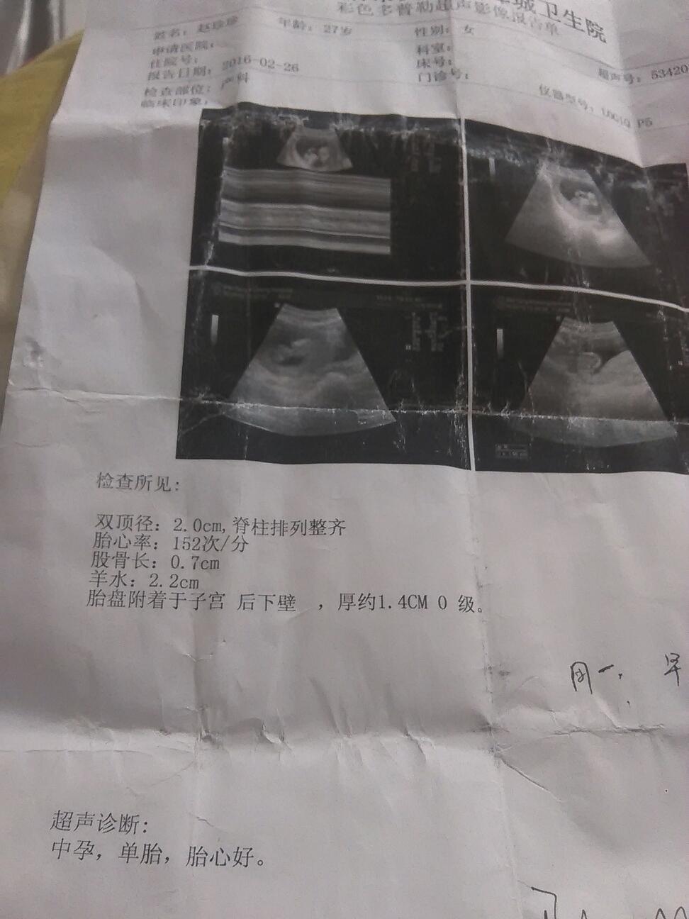 怀孕6个多月胎动少正常吗