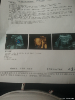 胎儿肾盂分离是什么意思