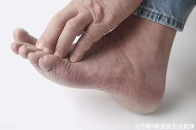 脚底板红是怎么回事