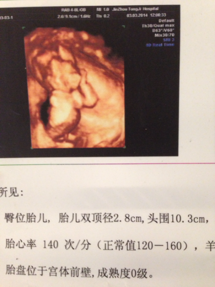 六个月胎儿双顶径标准