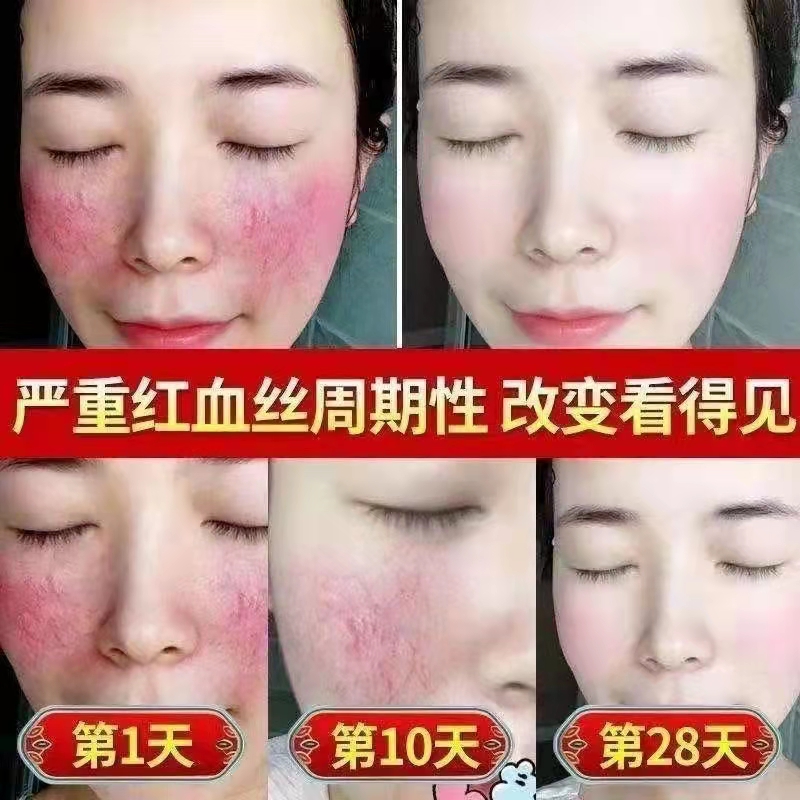 脸部角质层增厚
