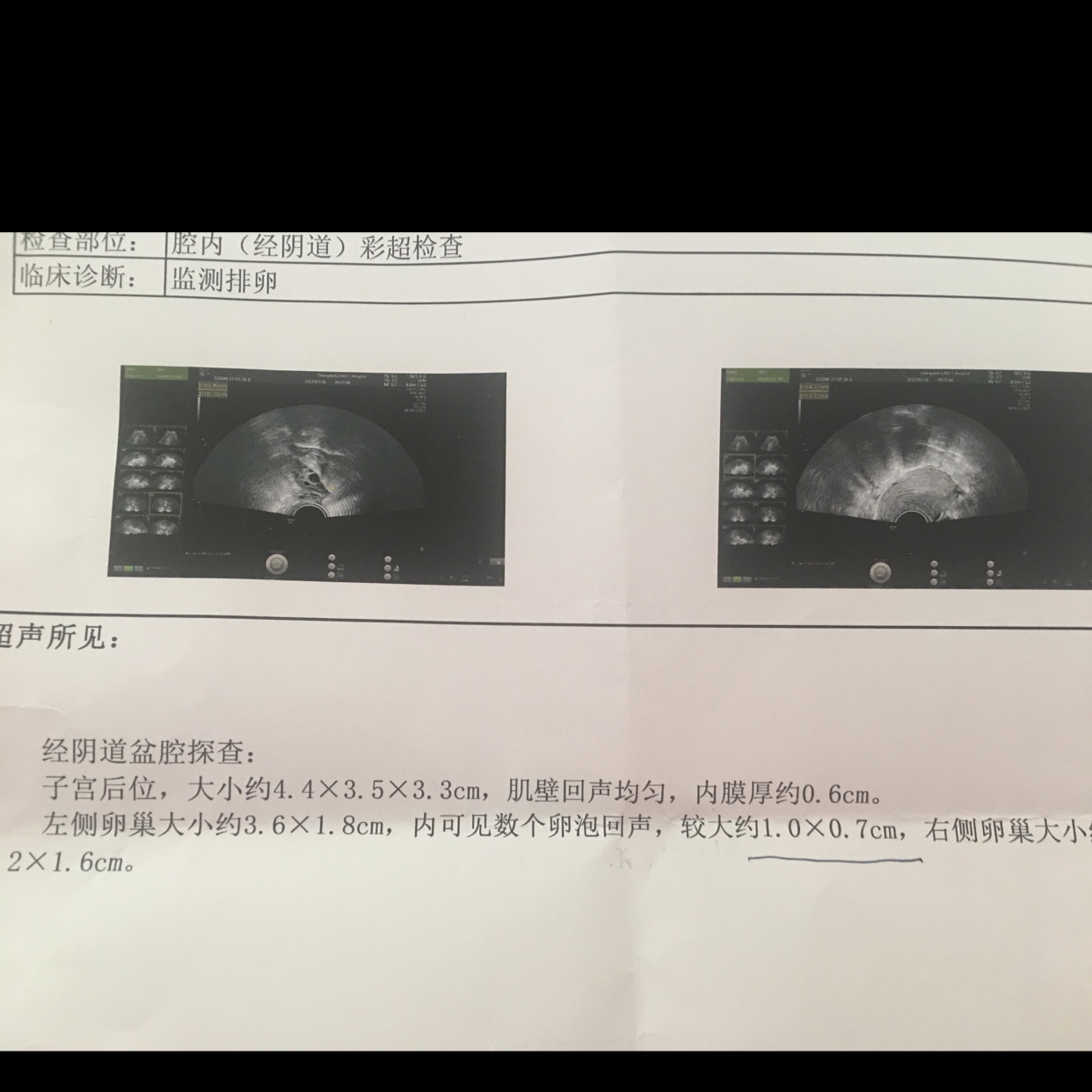 卵泡长不大会怀孕吗