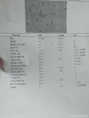 多少精子量可以导致怀孕吗