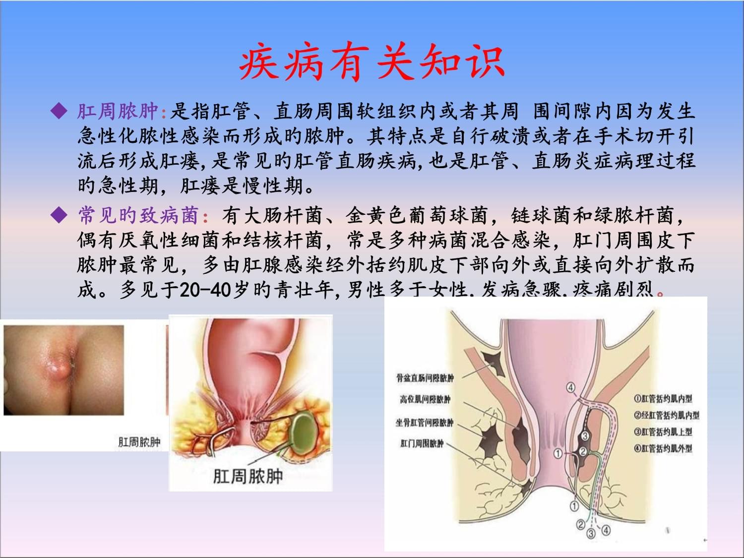 新生儿肛周脓肿图片