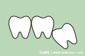 做梦梦到坏牙齿掉了是什么意思