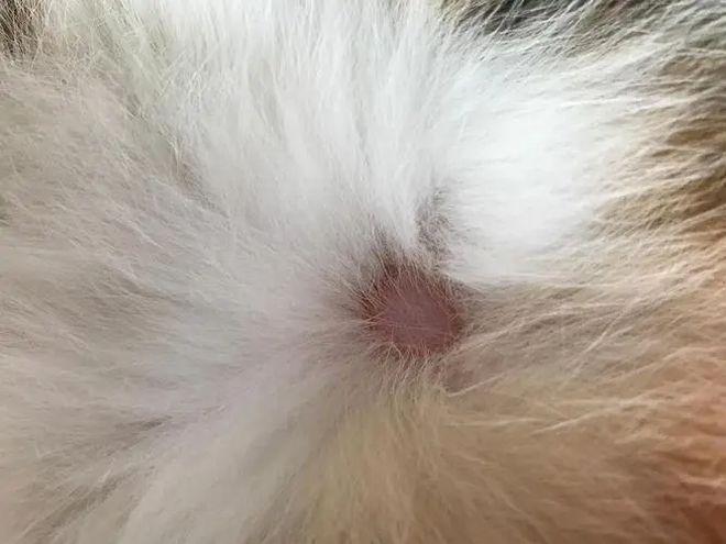 人长猫癣怎么治疗