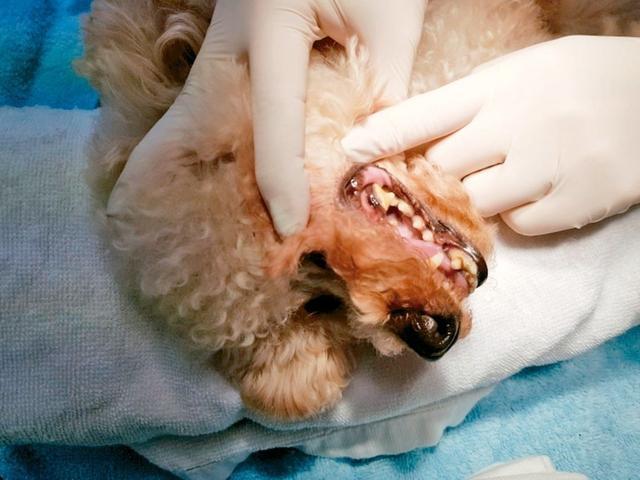唾液囊肿怎么治疗