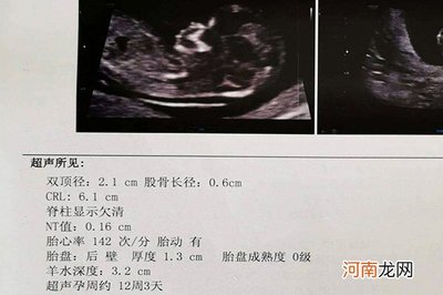 怀孕双胎12周双顶径是多少正常