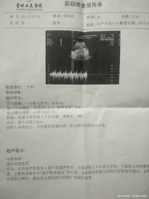 十七周的胎儿彩超图